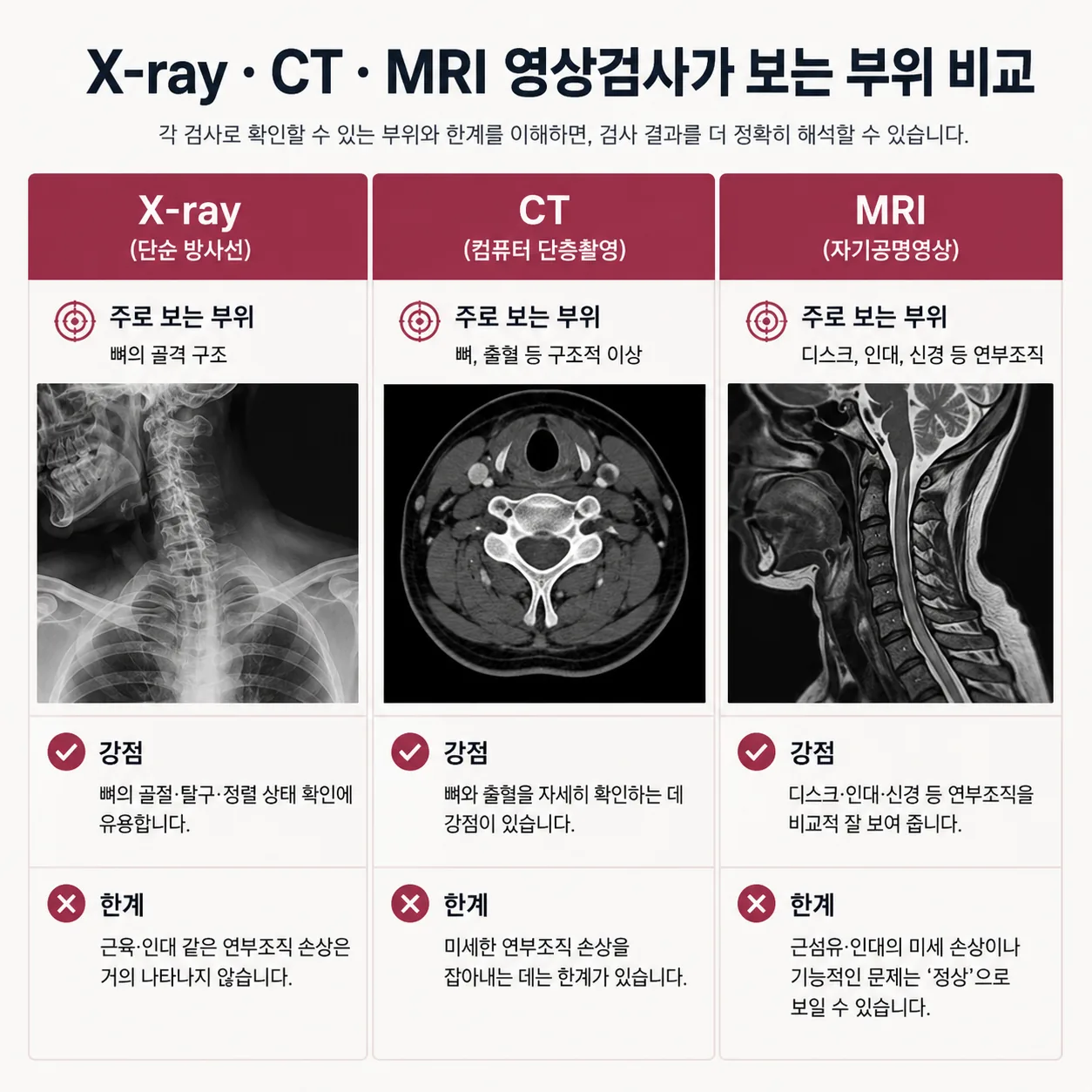 X-ray CT MRI 영상검사가 보는 부위 비교