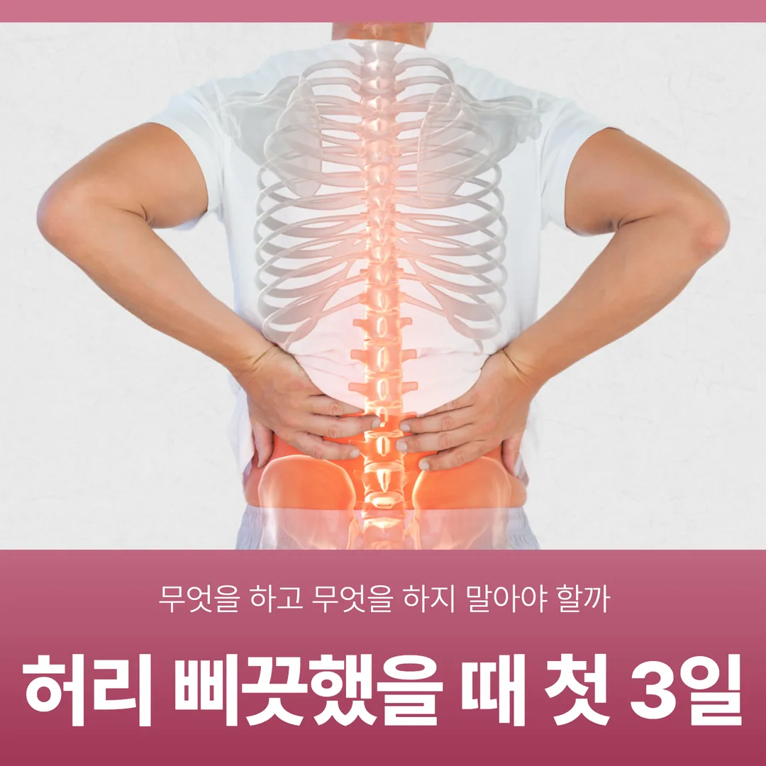 허리 삐끗했을 때 첫 3일, 무엇을 하고 무엇을 하지 말아야 할까
