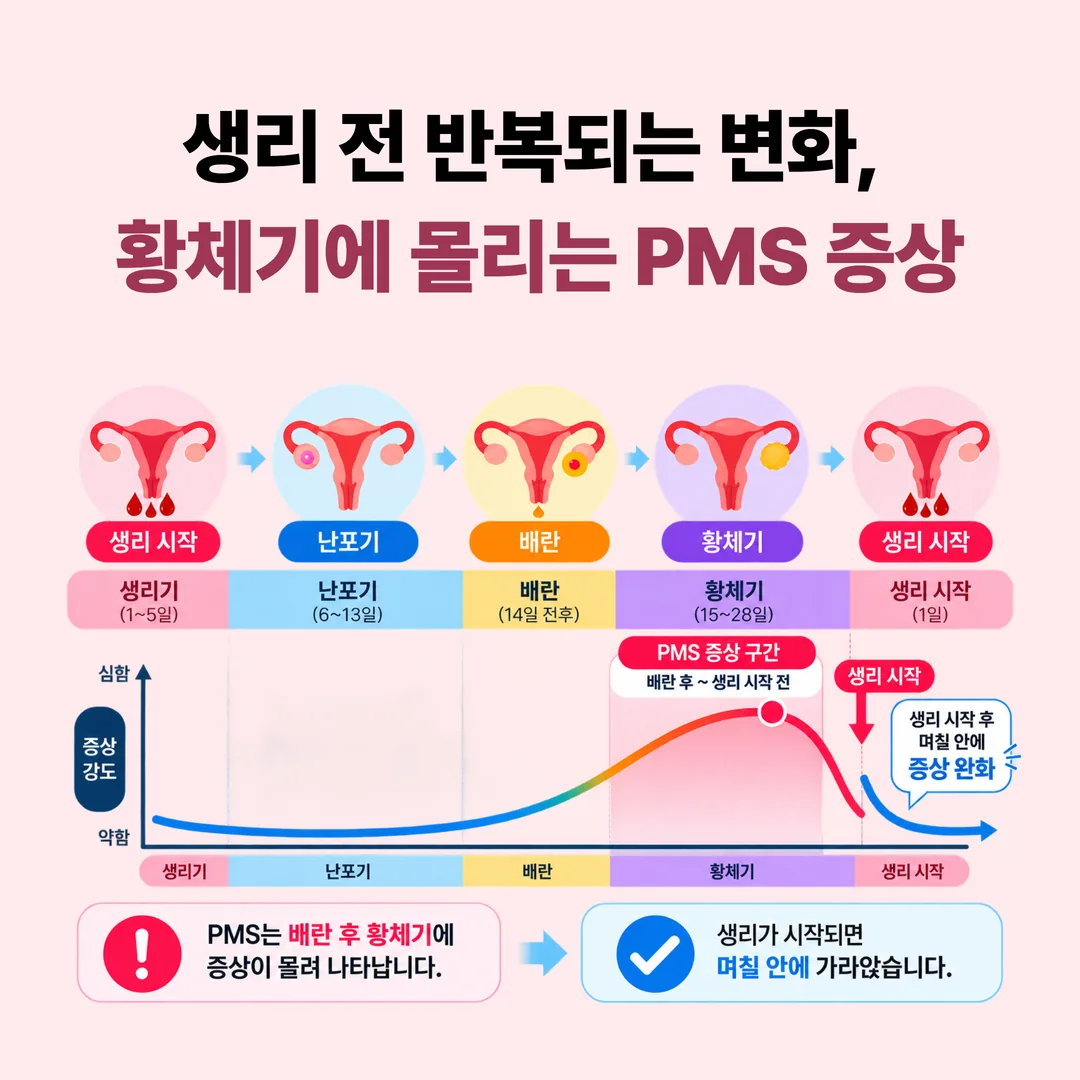 배란 후 황체기에 생리전증후군 증상이 나타나고 생리 시작 후 가라앉는 시기를 표시한 월경 주기 그림