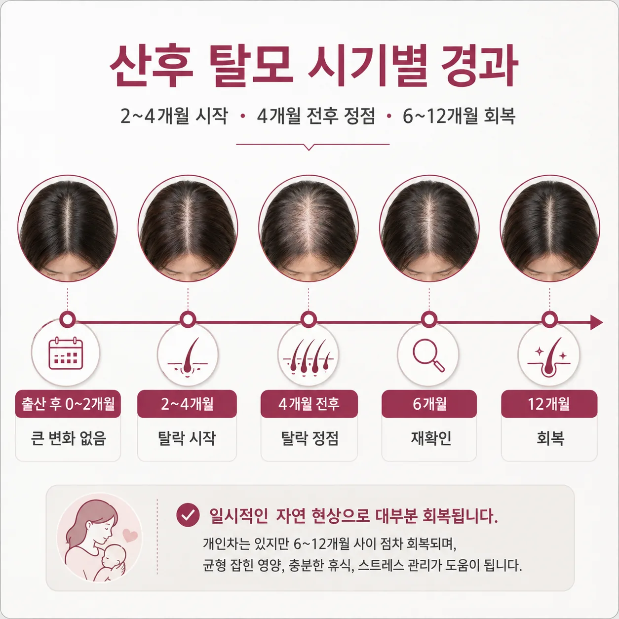 산후 탈모 시기별 경과 타임라인 — 출산 후 2~4개월 시작, 4개월 전후 정점, 6~12개월 회복
