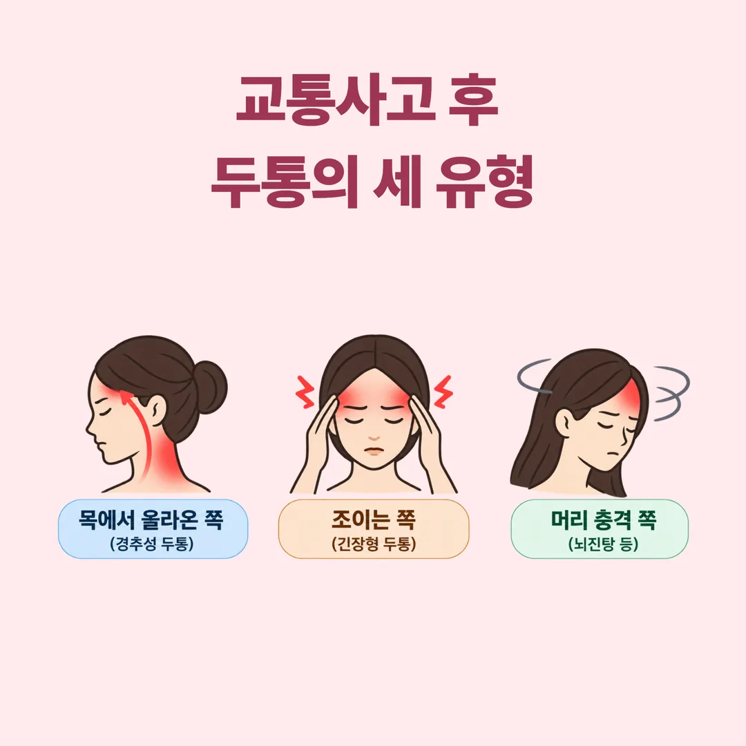 교통사고 후 두통을 목에서 올라온 쪽, 조이는 쪽, 머리 충격 쪽 세 갈래로 구분한 개념도