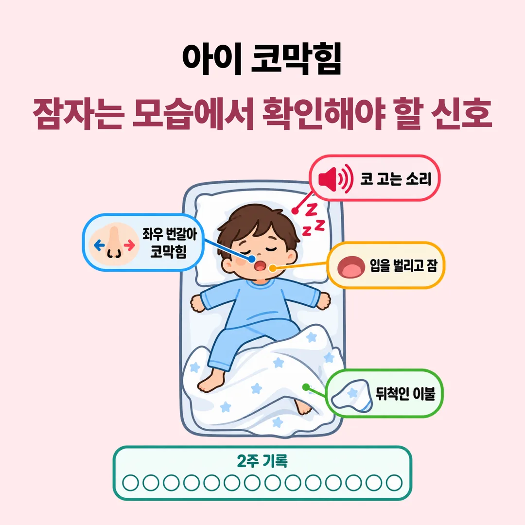 아이가 자는 동안 부모가 관찰하는 소아 비염 신호 네 가지 개념도