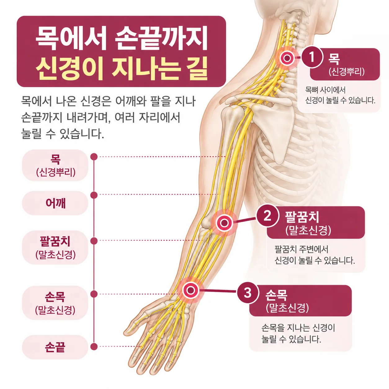 교통사고 팔저림 목에서 손끝까지 신경이 지나는 길 개념도