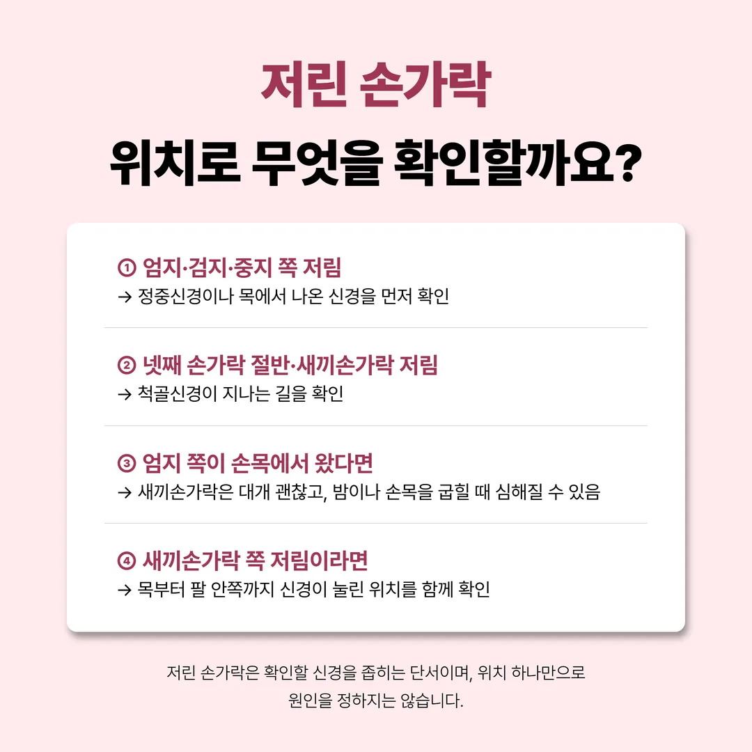 엄지 쪽 저림과 새끼손가락 쪽 저림 위치를 나눈 손 그림