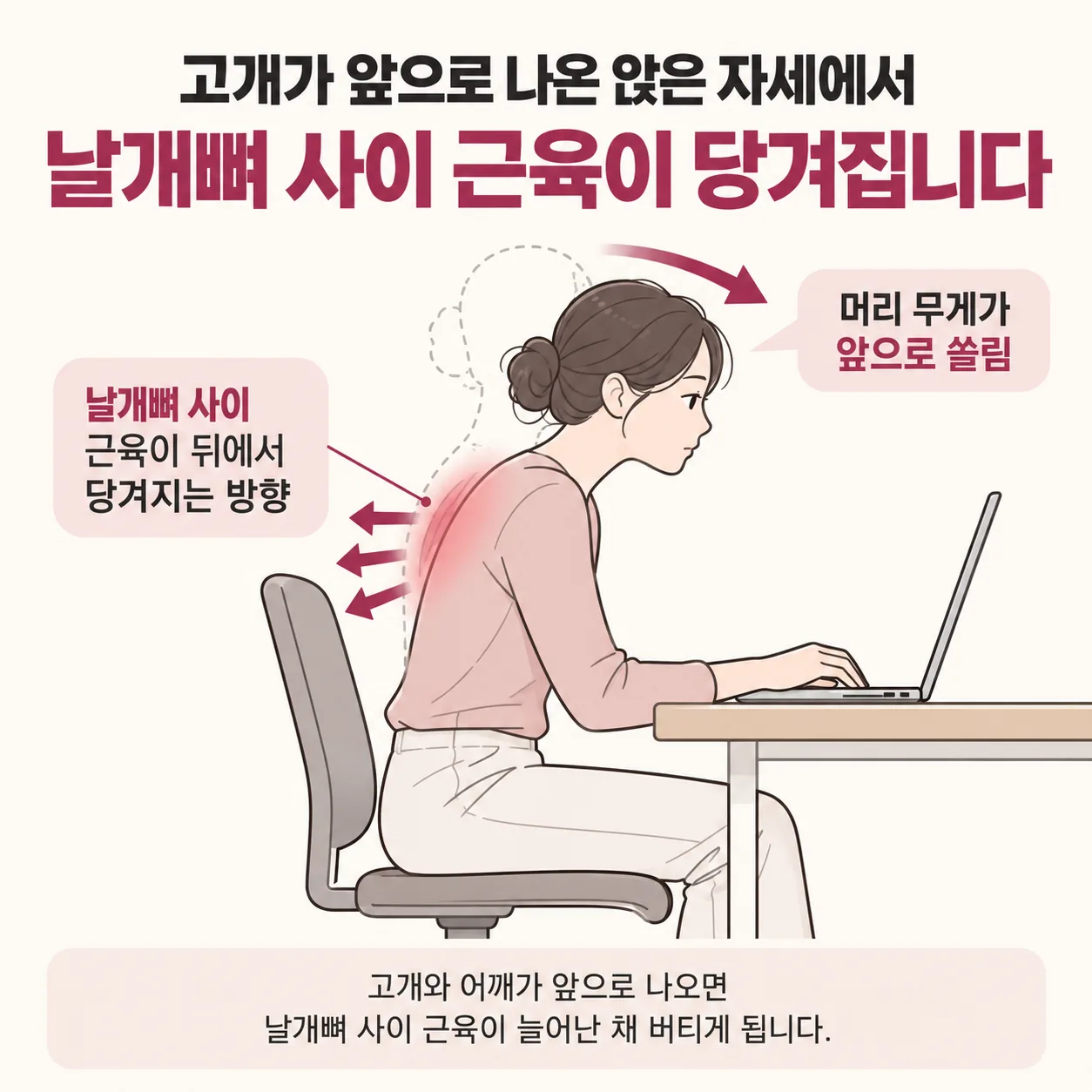 고개가 앞으로 나온 앉은 자세에서 날개뼈 사이 근육이 당겨지는 방향을 표시한 개념도