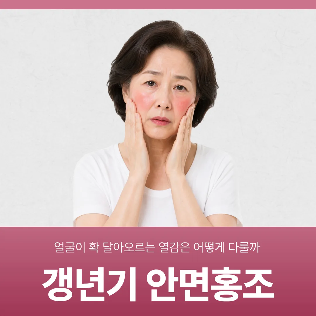 갱년기 안면홍조, 얼굴이 확 달아오르는 열감은 어떻게 다룰까